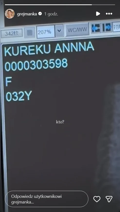 Wyświetlacz medycznego monitora pokazuje dane osobowe pacjentki, w tym imię, nazwisko, numer identyfikacyjny, płeć oraz wiek, na ciemnym tle.