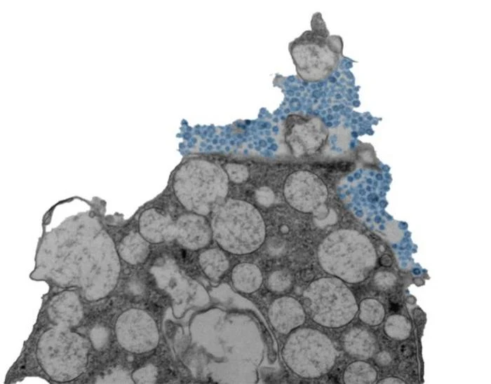 Mikrografia elektronowa przedstawiająca komórkę nabłonka nosowego człowieka uwalniającą rinowirusa (niebieski). Widok komórek pod mikroskopem elektronowym, z jasnoszarymi strukturami komórkowymi i skupiskiem niebieskich cząsteczek przypominających wirusy przy krawędzi komórki.