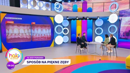 Jakub Rzeźniczak poddał się metamorfozie uśmiechu 