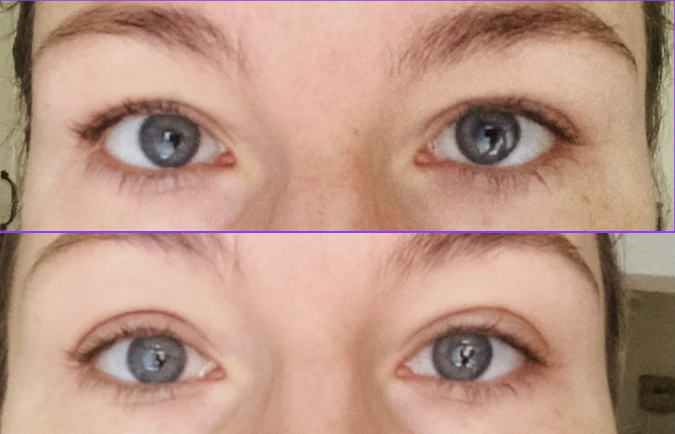 Porównanie wyglądu oczu jednej osoby na dwóch zbliżeniach, ułożonych jedno nad drugim. Oczy są niebieskie, a różnica między zdjęciami może dotyczyć rozwarcia powiek lub oświetlenia.