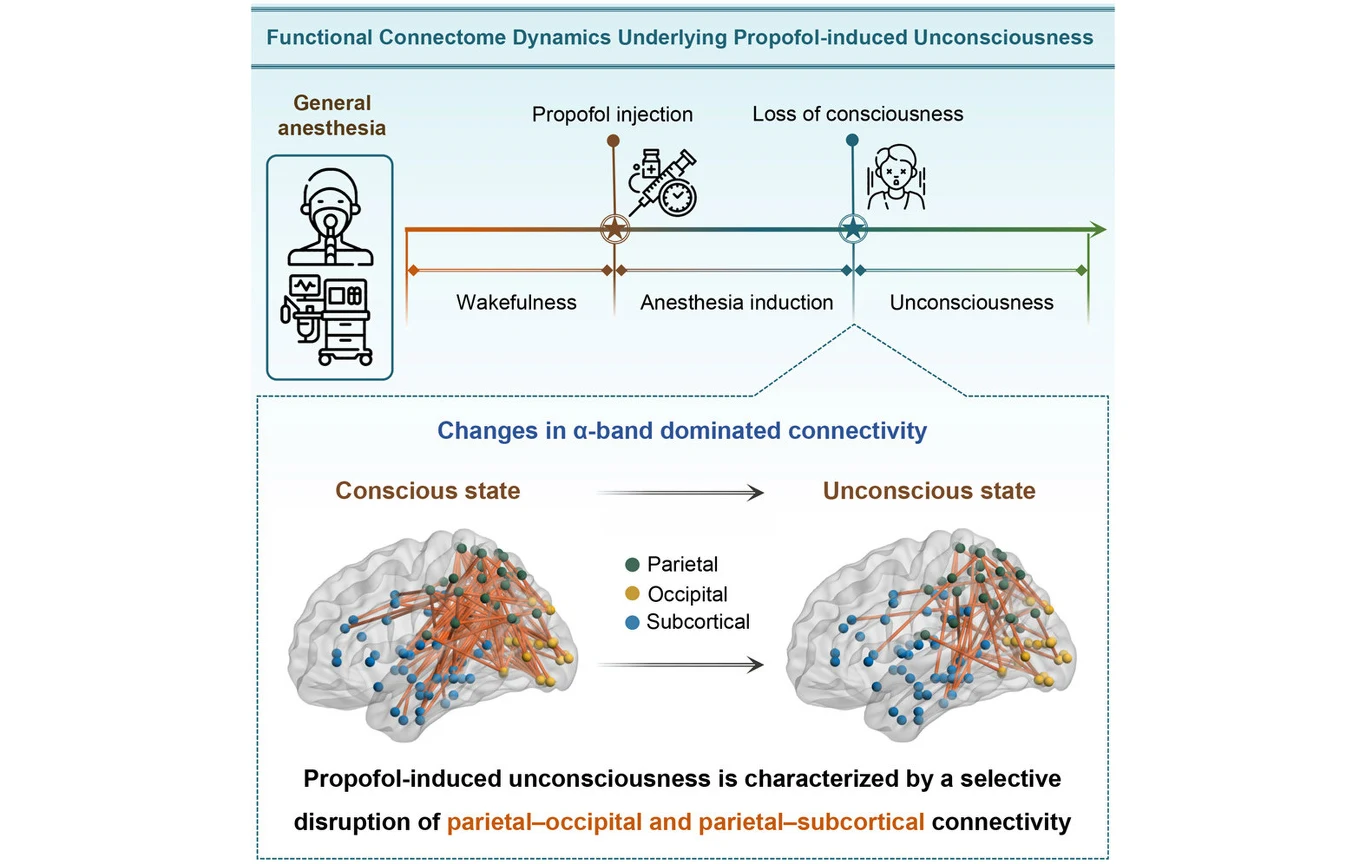 Schematyczny diagram procesu znieczulenia ogólnego przy użyciu propofolu oraz wpływu tego leku na łączność sieci neuronowych w mózgu, zilustrowany porównaniem stanu świadomości i nieświadomości oraz zmian w połączeniach pomiędzy regionami ciemieniowym,...