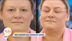 Co robić, gdy brwi są słabe i wypadają? 