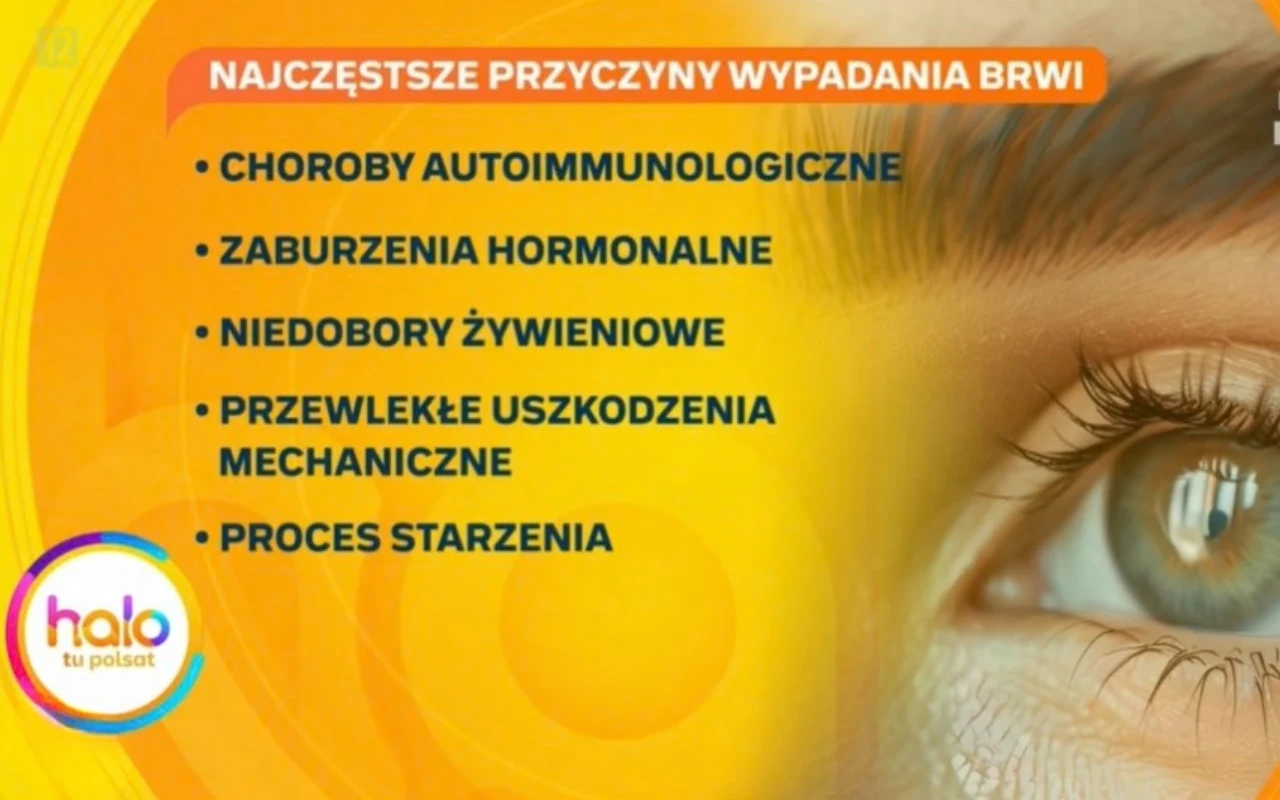 Najczęstsze przyczyny wypadania brwi - infografika