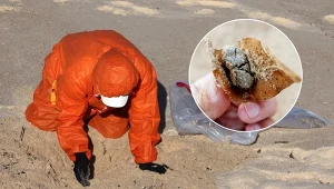 Skrzep w kanałach wielkości czterech autobusów. To źródło tajemniczych kul