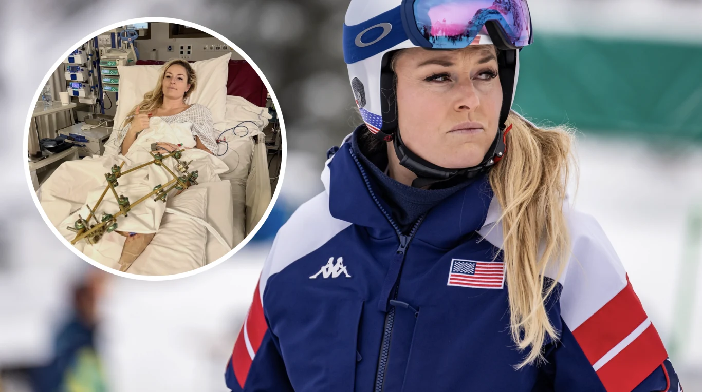 Lindsey Vonn przeszła kolejną operację Zawodniczka w stroju narciarskim z logiem amerykańskiej drużyny spogląda w bok, na twarzy widoczna determinacja i skupienie; w okrągłej ramce zdjęcie kobiety leżącej na szpitalnym łóżku z nogą w gipsie, otoczona sprzętem medycznym.