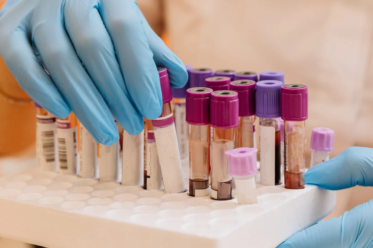 Ręce w niebieskich rękawiczkach ochronnych umieszczają probówki z krwią w białym stojaku laboratoryjnym, większość probówek posiada fioletowe nakrętki.