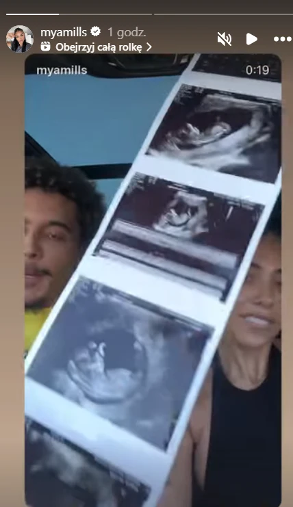 Uśmiechnięta para prezentuje zdjęcia USG swojego nienarodzonego dziecka, trzymając długi pasek z wydrukami badań w jasnym wnętrzu.