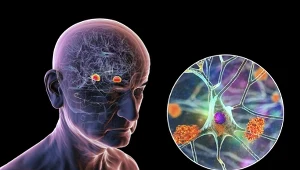 Chorobie Alzheim,era okazują się sprzyjać zanieczyszczenia powietrza