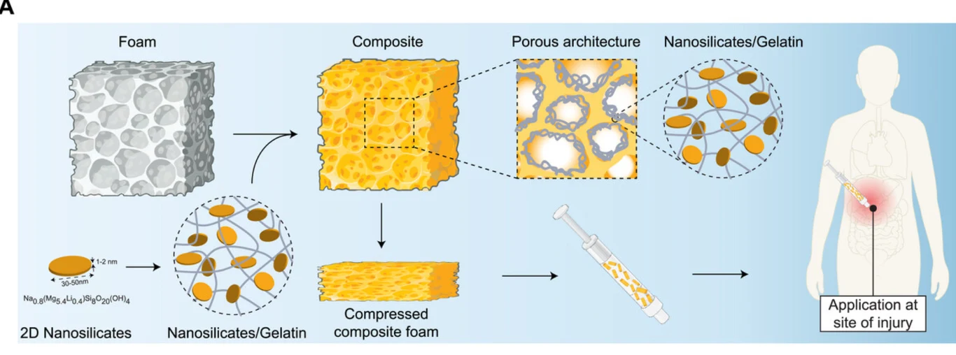 Schemat działania nowego materiału. Schemat procesu tworzenia kompozytu z nanokrzemianów i żelatyny w postaci pianki o porowatej strukturze, aplikowanej następnie do rany w ludzkim ciele za pomocą strzykawki.