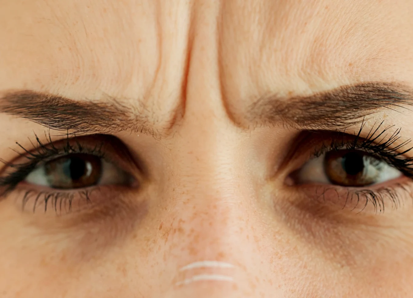 Jak wygładzić lwią zmarszczkę? Ten domowy sposób pozwoli ci się jej pozbyć Jak wygładzić lwią zmarszczkę? Ten domowy sposób pozwoli ci się jej pozbyć