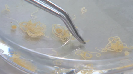 Zdaniem badaczy pasożyty atakujące m.in. śledzie mogą pomóc ludziom 