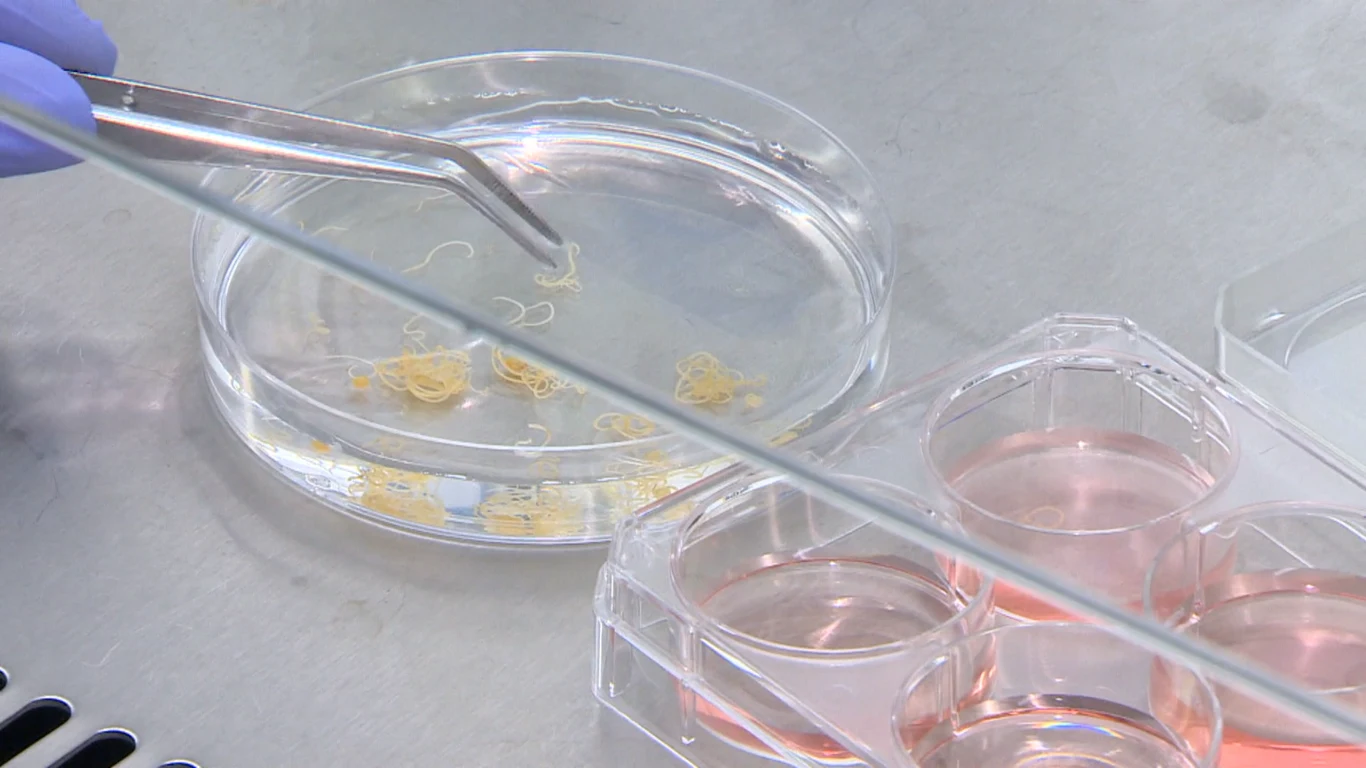 Szkiełko laboratoryjne z kilkoma żółtymi nitkowatymi obiektami zanurzonymi w cieczy, obok znajduje się pojemnik z trzema komorami wypełnionymi różowym płynem, pęseta w rękawiczce trzyma jeden z obiektów.