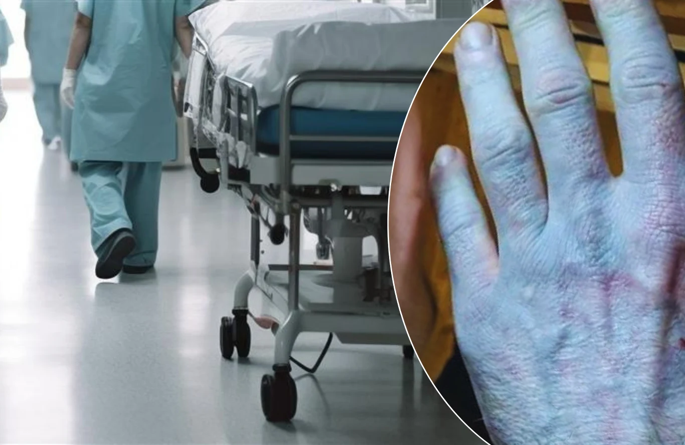 Niebieskawa dłoń mężczyzny na tle szpitalnego korytarza i personelu przy łóżku na kółkach.