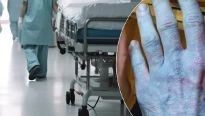 Mężczyzna po przebudzeniu odkrył, że jego skóra przybrała niebieską barwę. Zgłosił się do szpitala.