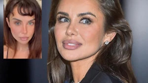 Natalia Siwiec posłuchała fanów i wygląda jak pieczarka. Jest co ratować?