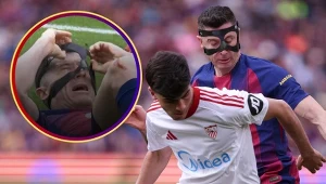 Tego "Lewy" obawiał się najbardziej. Jest gorzej niż myślano. Fatalny obrazek