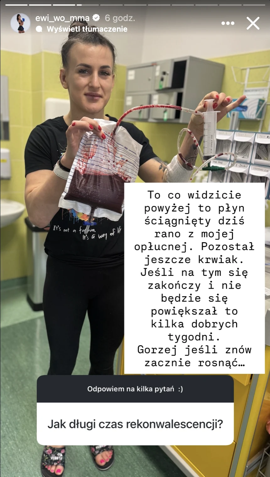 kobieta stojąca w sali szpitalnej trzyma w rękach worek z odciągniętym płynem medycznym, mając widoczny opatrunek na klatce piersiowej; w tle szpitalny sprzęt i zielone ściany