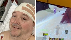 Implant mózgowy N1 pozwala grać w World of Warcraft i mówić myślami