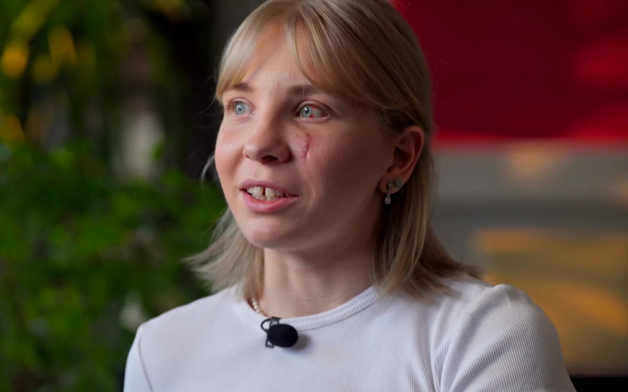 Kamila Sellier Kamila Sellier podczas nagrywania materiału, z widoczną blizną na policzku; w tle rozmyta zieleń roślin.