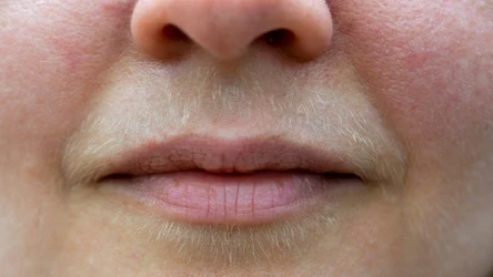 Domowy sposób na "wąsik". Bez depilacji i drogich zabiegów. 