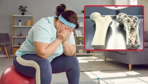 Nie ma dowodów, że semaglutyd niszczy kości i mięśnie. To normalne efekty odchudzania, którym można łatwo zapobiec