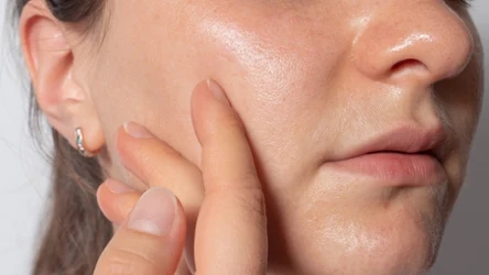 Domowy sposób na lepszą cerę i mniej widoczne pory. Sięgnij po tę maseczkę. 