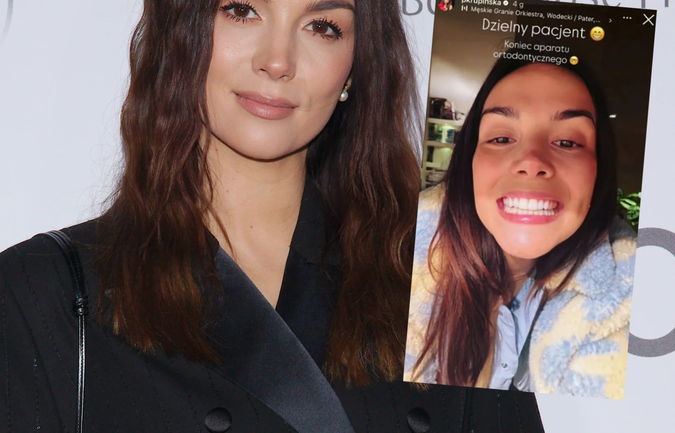 Młoda kobieta o długich ciemnych włosach ubrana w elegancki, czarny żakiet, obok niej znajduje się nakładka zdjęcia z bliska przedstawiająca tę samą kobietę z szerokim uśmiechem, chwalącą się zębami po zakończeniu leczenia ortodontycznego.