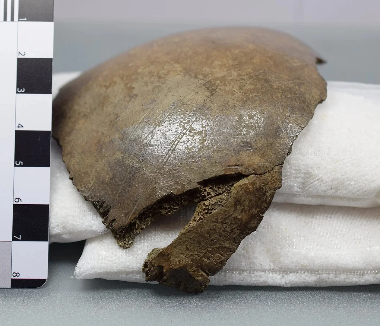Fragment czaszki ułożony na białej poduszce obok miarki pomiarowej, z widocznymi śladami pęknięć i uszkodzeń na powierzchni kości.