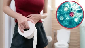 USA zmagają się z epidemią cyklosporozy wywołaną przez pasożyta. Głównym objawem jest uciążliwa biegunka