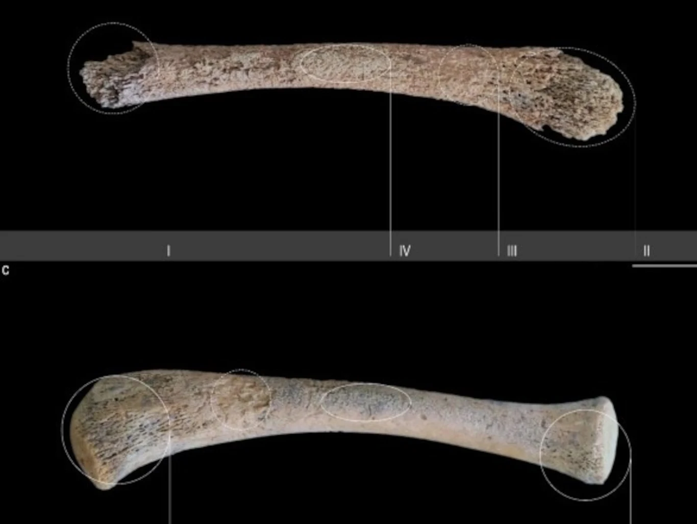 Archeolodzy zidentyfikowali w kościach sprzed 6000 lat najstarsze ślady zabiegu porodowego. Dwa fragmenty kości sprzed 6000 lat na czarnym tle, oznaczone okręgami i rzymskimi cyframi.