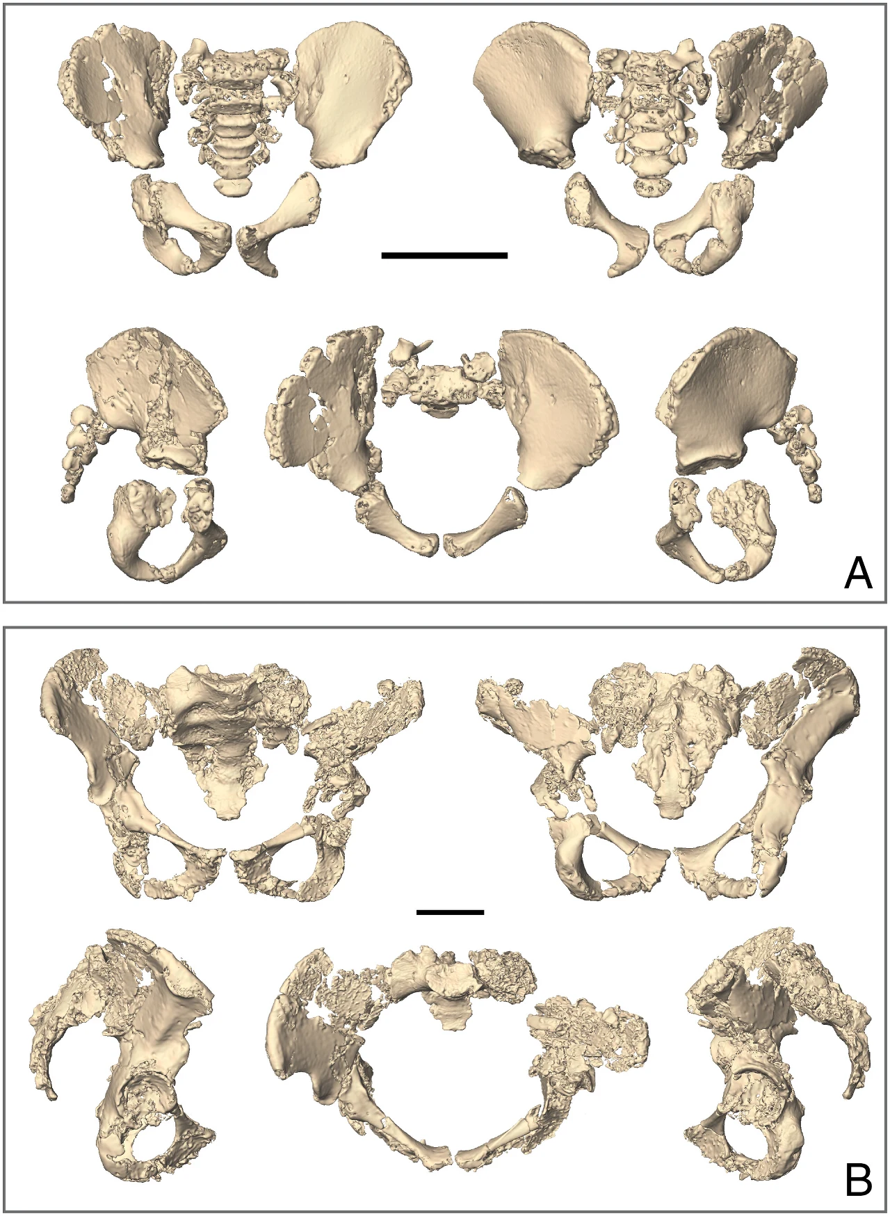 Rekonstrukcja miednic neandertalczyków. A - niemowlę z jaskini Dederiyeh, B - młoda dorosła kobieta z Sima de las Palomas. Modele 3D miednicy przedstawione z różnych perspektyw, wyraźnie widoczne kości biodrowe, kości krzyżowe oraz zmiany patologiczne w strukturach kości na dolnym panelu w porównaniu do panelu górnego.