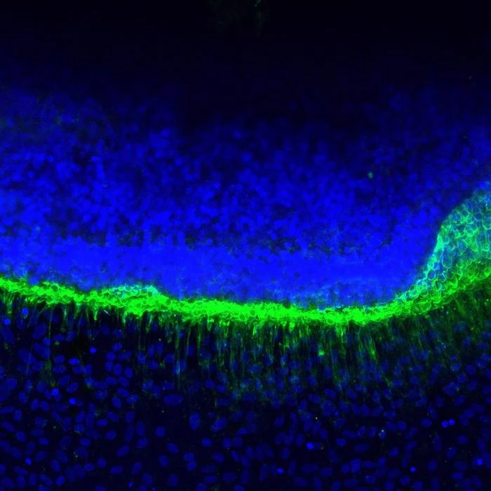 Warstwa komórek oznaczona intensywnie fluorescencyjną zielenią przecina poziomo niebieskie pole skupisk komórkowych, tworząc wyraźny pas o zróżnicowanej grubości.