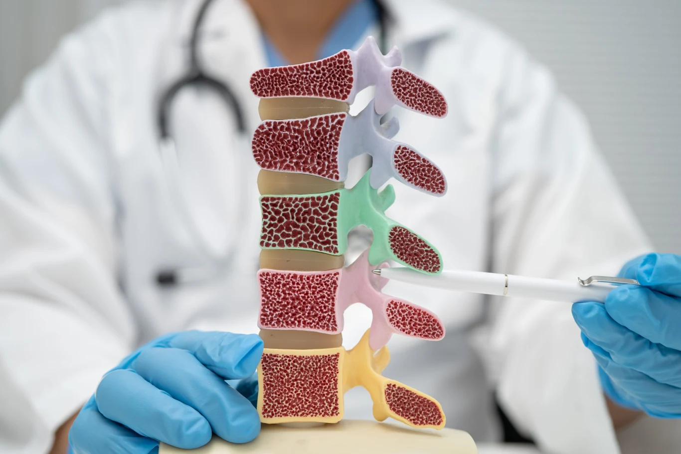 Pierwszy objaw osteoporozy to wcale nie złamanie. Problem zaczyna się 20 lat wcześniej Model ludzkiego kręgosłupa z wyraźnie zaznaczonym przekrojem kręgów, trzymany przez osobę w białym fartuchu i rękawiczkach, wskazującego fragment kręgosłupa długopisem.