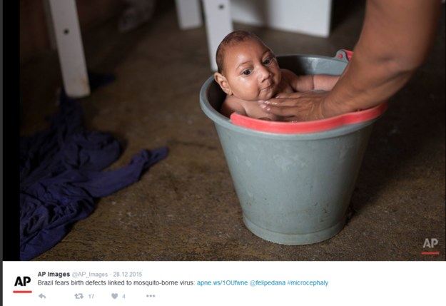 1 na 10 kobiet zakażonych wirusem Zika urodziła dziecko z wadami, fot. Twitter /