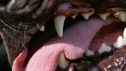 10-latek zaatakowany przez psa. Chłopca uratował policjant