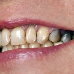 10 produktów, które najbardziej plamią zęby