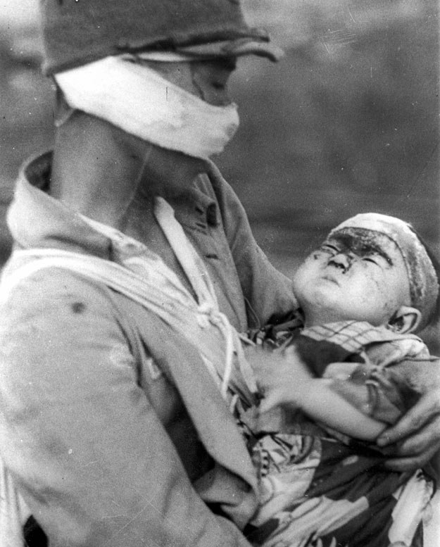 10 sierpnia 1945 r., Nagasaki: Ojciec czeka ze swym dzieckiem na ewakuację /AFP