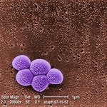 1000-letni lek nadzieją na pokonanie groźnej superbakterii
