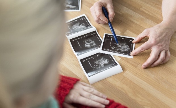 11 dzieci zmarło podczas badań klinicznych. Okazało się, że lek uszkadza płuca