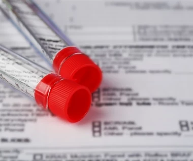 12 powodów dla których warto wykonać morfologię. Im częściej się badasz, tym więcej wiesz