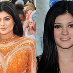 16-letnia Kylie Jenner poddała się operacji plastycznej?