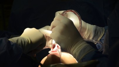 2 pary bliźniąt zdecydowały się na operacje plastyczne. Wciąż trudno się zorientować, kto jest kim