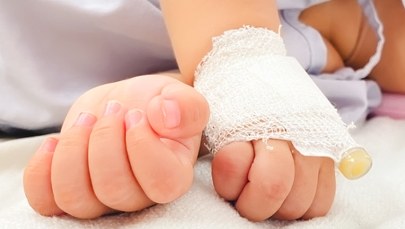 20-miesięczne dziecko z urazem czaszki i kończyn w szpitalu