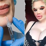 25-latka jest fanką operacji plastycznych. Jej usta są największe na świecie  