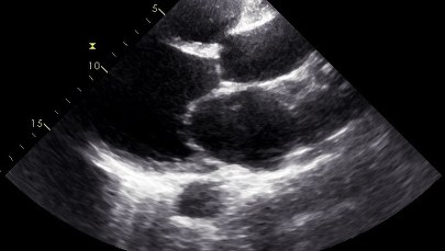 25 procent par ma problem z zajściem w ciążę