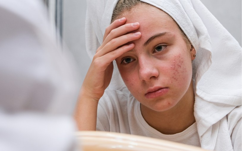 3 codzienne błędy, które sprawiają, że twoja skóra wygląda gorzej