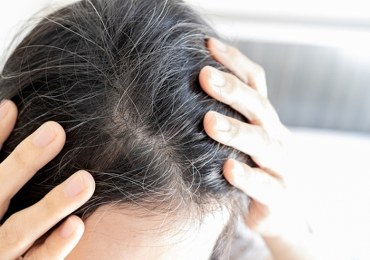 3 produkty spożywcze opóźniające siwienie włosów 