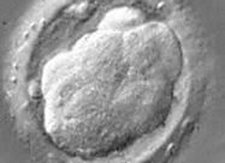 5-dniowy ludzki embrion /AFP