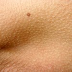 5 domowych sposobów na pozbycie się gęsiej skórki