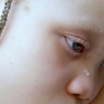 5-latka została porwana i zabita w Burundi. Tylko dlatego, że była albinoską 